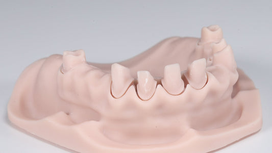Modello dentale stampato in 3D con resina Portux: dettaglio di monconi e preparazioni